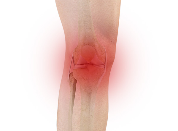 Knee Pain